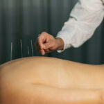 acupuncture in chiang mai